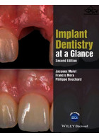 Implant Dentistry at a Glance | دندانپزشکی ایمپلنت در یک نگاه