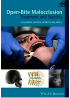 Open-Bite Malocclusion : Treatment and Stability | اصلاح نامرتبی دندان