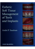 Esthetic Soft Tissue Management of Teeth and Implants | مدیریت بافت نرم زیبایی دندان و ایمپلنت