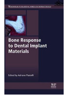 Bone Response to Dental Implant Materials | واکنش استخوان به مواد ایمپلنت دندان