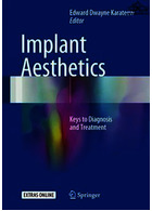 Implant Aesthetics | زیبایی ایمپلنت