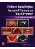Evidence-based Implant Treatment Planning and Clinical Protocols | برنامه ریزی و پروتکل های بالینی درمان ایمپلنت
