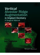 Vertical Alveolar Ridge Augmentation in Implant Dentistry : A Surgical Manual | تقویت ریج آلوئولار عمودی در ایمپلنت