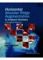 Horizontal Alveolar Ridge Augmentation in Implant Dentistry : A Surgical Manual | تقویت برآمدگی آلوئولی افقی در دندانپزشکی ایمپلنت
