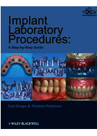 Implant Laboratory Procedures : A Step-by-Step Guide | روش های آزمایشگاهی ایمپلنت
