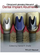 Clinical and Laboratory Manual of Dental Implant Abutments | راهنمای بالینی و آزمایشگاهی اباتمنت ایمپلنت دندان