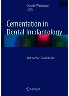 Cementation in Dental Implantology : An Evidence-Based Guide2015