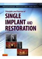 Principles and Practice of Single Implant and Restoration | اصول و عملکرد ایمپلنت و ترمیم
