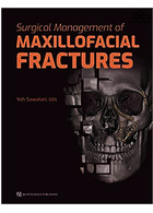 Surgical Management of Maxillofacial Fractures | مدیریت جراحی شکستگی های فک و صورت