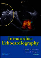 Intracardiac Echocardiography | اکوکاردیوگرافی