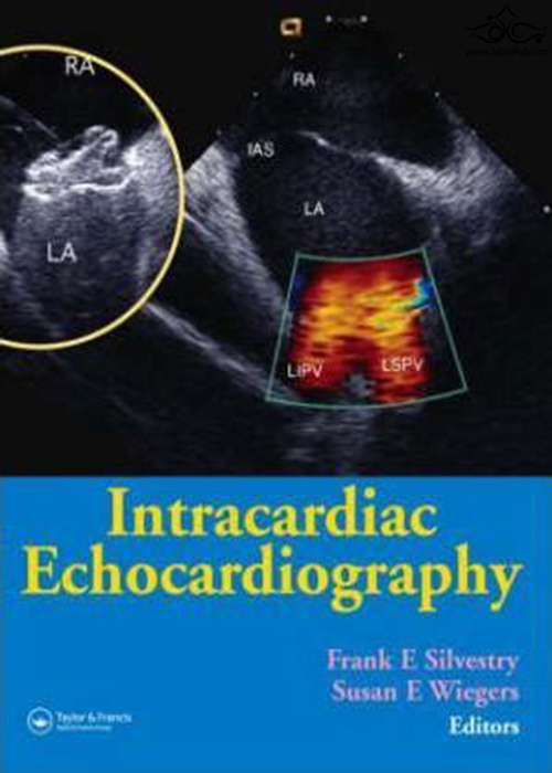 Intracardiac Echocardiography  ‎ CRC Press