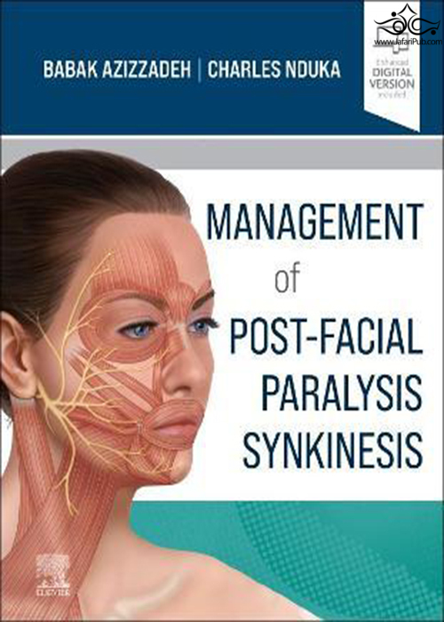 Management of Post-Facial Paralysis Synkinesis ELSEVIER