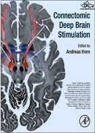 Connectomic Deep Brain Stimulation | تحریک مغز عمیق اتصال