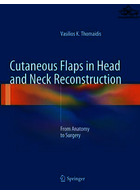 Cutaneous Flaps in Head and Neck Reconstruction | فلپ های پوستی در بازسازی سر و گردن
