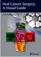 Oral Cancer Surgery : A Visual Guide | جراحی سرطان دهان