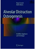 Alveolar Distraction Osteogenesis | استئوژنز حواس پرتی آلوئولار