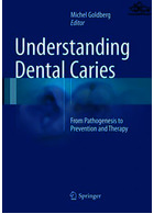 Understanding Dental Caries | آشنایی با پوسیدگی دندان
