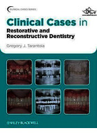 Clinical Cases in Restorative and Reconstructive Dentistry | موارد بالینی در دندانپزشکی ترمیمی و ترمیمی