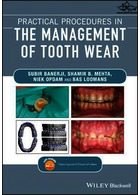 Practical Procedures in the Management of Tooth Wear | رویه های عملی در مدیریت سایش دندان
