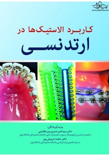 کاربرد الاستیک ها در ارتدنسی