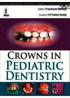 Crowns in Pediatric Dentistry | تاج در دندانپزشکی کودکان