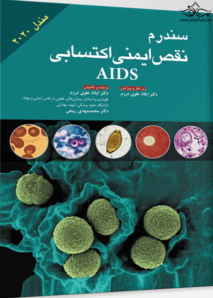 سندرم نقص ایمنی اکتسابی AIDS  مندل 2020