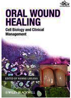 Oral Wound Healing | درمان زخم دهان