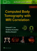 Computed Body Tomography with MRI Correlation | توموگرافی کامپیوتری بدن با همبستگی MRI