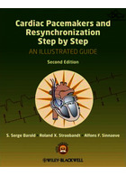 Cardiac Pacemakers and Resynchronization Step by Step | ضربان سازهای قلبی و همگام سازی مجدد مرحله به مرحله