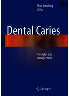 Dental Caries2016 | پوسیدگی دندان