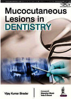 Mucocutaneous Lesions in Dentistry | ضایعات پوستی مخاطی در دندانپزشکی
