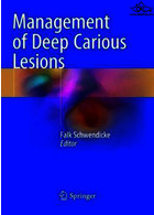 Management of Deep Carious Lesions 2018 | مدیریت ضایعات پوسیدگی عمیق