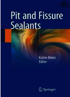 Pit and Fissure Sealants 2018 | پیت و فیشور سیلانت