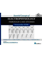 Essential Concepts of Electrophysiology Through Case Studies2015 | مفاهیم اساسی الکتروفیزیولوژی از طریق مطالعات موردی