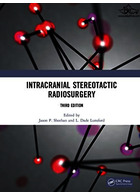Intracranial Stereotactic Radiosurgery 2021 | رادیوسرجری استریوتاکتیک داخل جمجمه ای