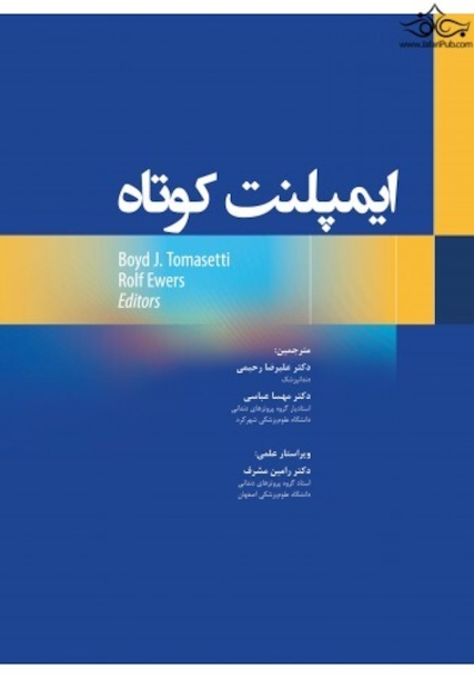 ایمپلنت کوتاه
