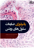 پاتولوژی ضایعات سلول های روشن