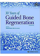 30Years of Guided Bone Regeneration in Implant Dentistry | 30 سال از بازسازی استخوان هدایت شده در دندانپزشکی ایمپلنت