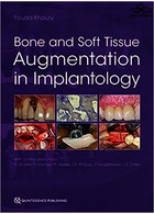 Bone and Soft Tissue Augmentation in Implantology 2022 | تقویت استخوان و بافت نرم در ایمپلنتولوژی