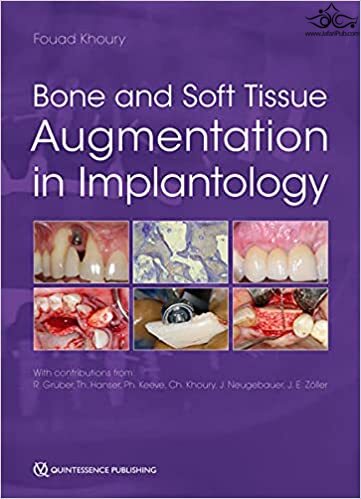 Bone and Soft Tissue Augmentation in Implantology 2022  Quintessence Publishing Co Inc.,U.S
