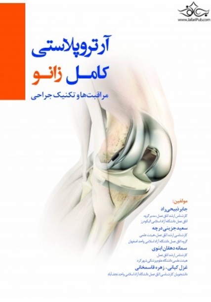 آرتروپلاستی کامل زانو