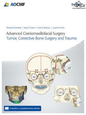Advanced Craniomaxillofacial Surgery : Tumor, Corrective Bone Surgery, and Trauma 2020 Thieme