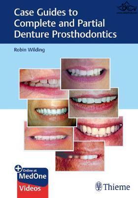 Case Guides to Complete and Partial Denture Prosthodontics 2020 Thieme