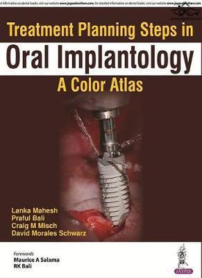 Treatment Planning Steps in Oral Implantology 2018  Jaypee Brothers Medical Publishers 