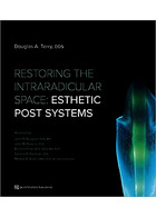 Restoring the Intraradicular Space: Esthetic Post Systems 1st Edition | بازیابی فضای داخل رادیکولی