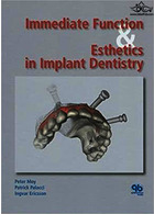 Immediate Function and Esthetic in Implant Dentistry | عملکرد فوری و زیبایی در دندانپزشکی ایمپلنت