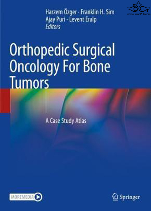 Orthopedic Surgical Oncology For Bone Tumors Springer