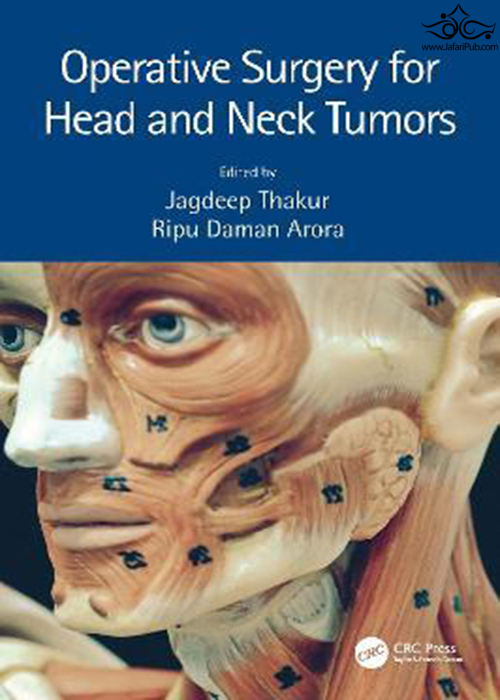 Operative Surgery for Head and Neck Tumors Taylor & Francis Ltd