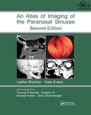 Atlas of Imaging of the Paranasal Sinuses, Second Edition Taylor & Francis Ltd