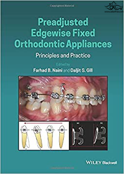 Preadjusted Edgewise Fixed Orthodontic Appliances: Principles and Practice 1st Edición Wiley-Blackwell